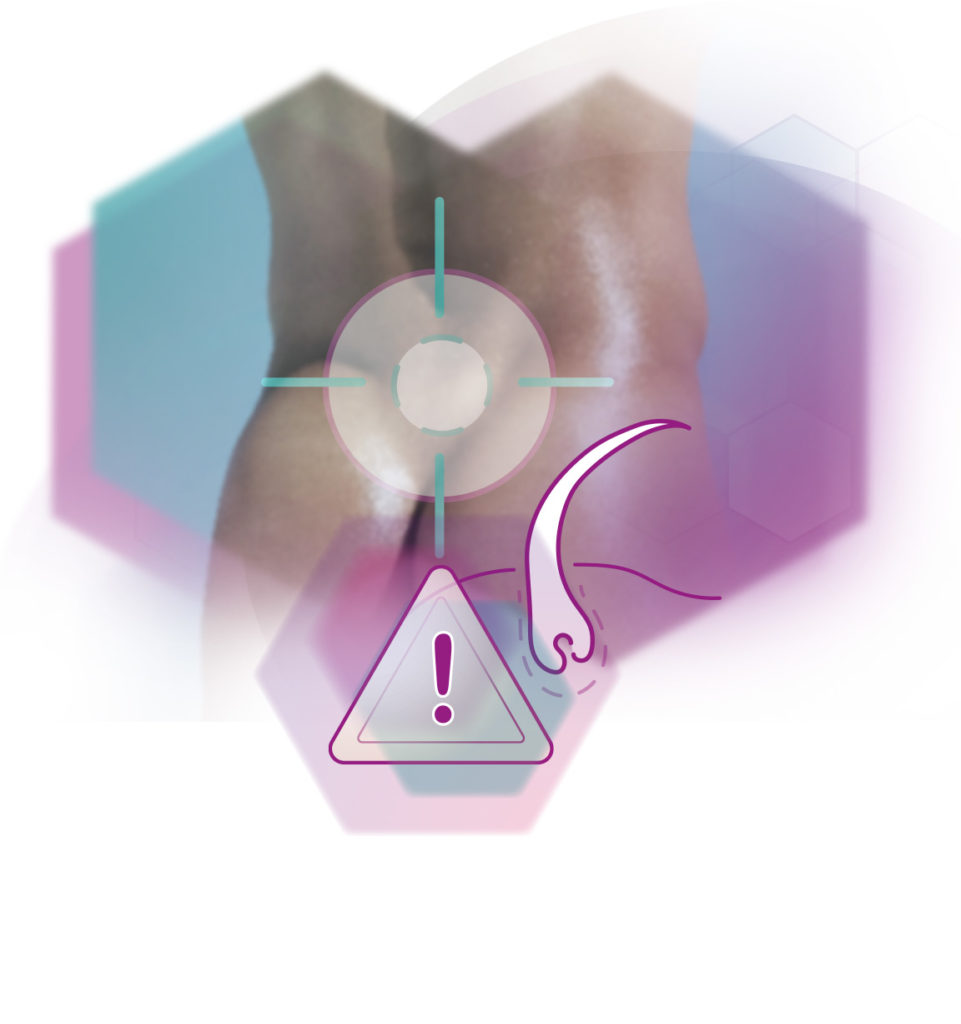 photo graphic coccyx area