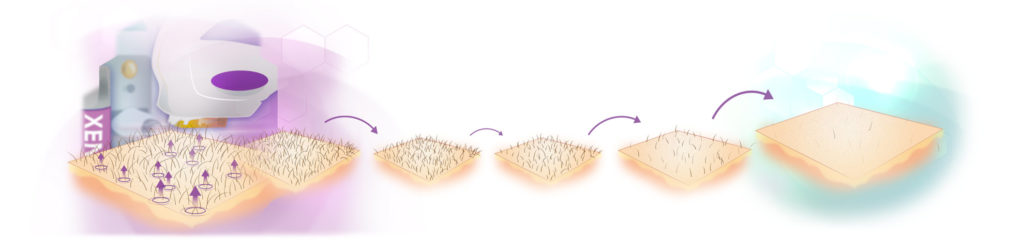 Verschiedene Phasen der Haarentfernung