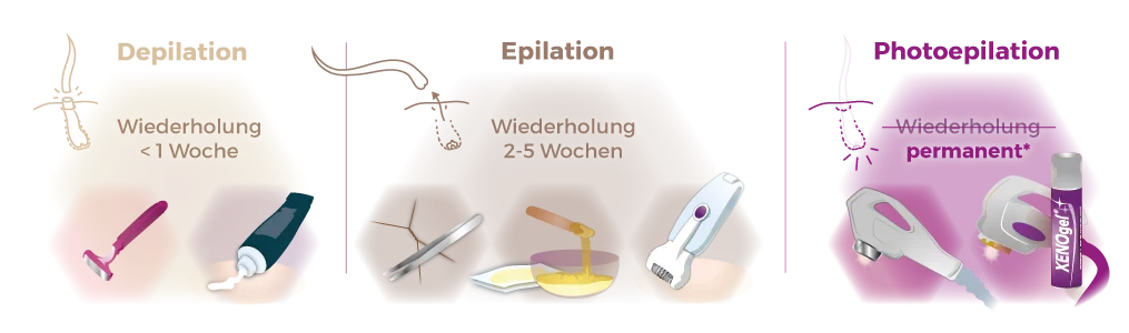 Vergleich Infografik Haarentfernugnsmethoden - Depilation, Epilation und Photoepilation