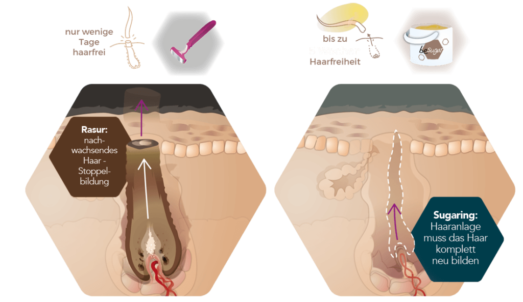 Infografik Sugaring