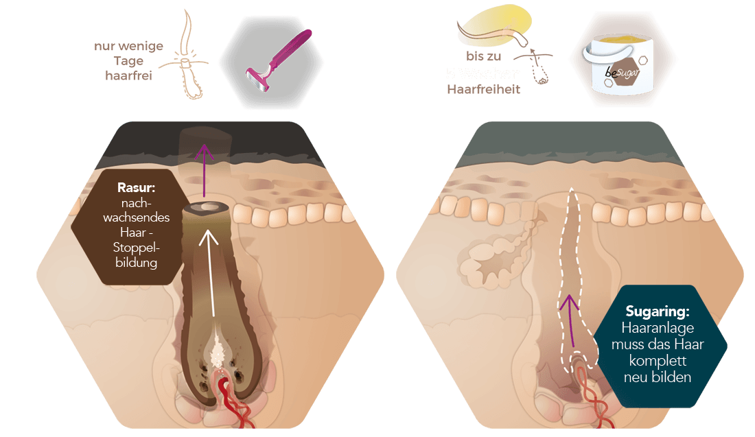 Infografik Sugaring