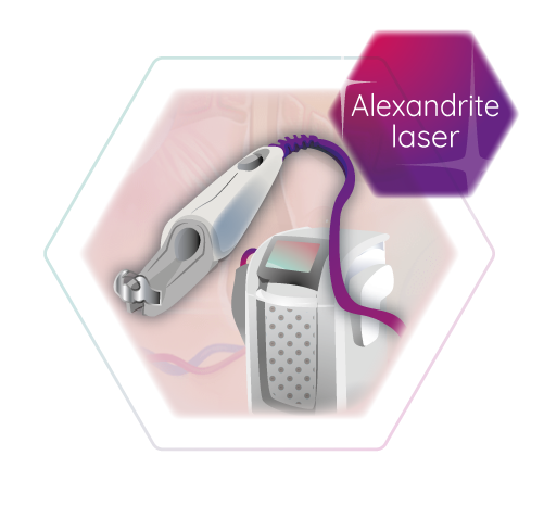 graphic alexandrite laser hair removal