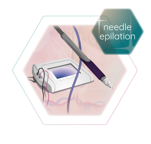 graphic illustration needle epilation electro