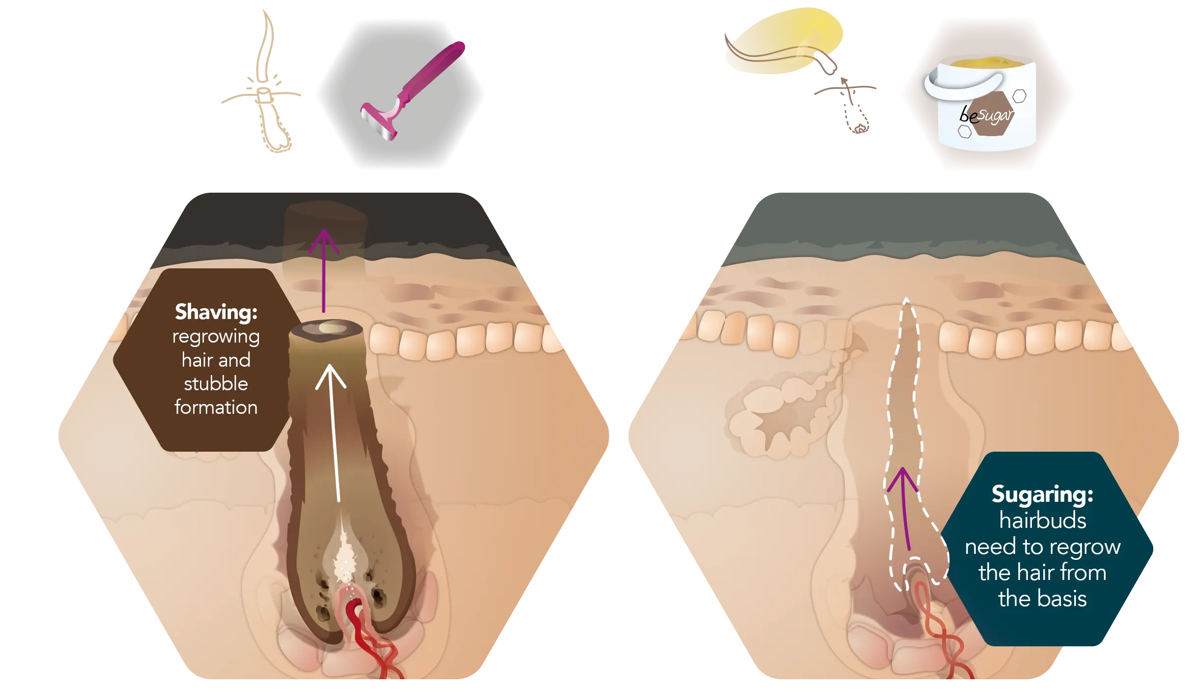 infographic comparison shaving sugaring