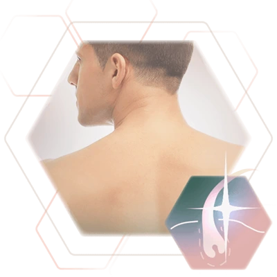Photo body region man neck permanent hair removal