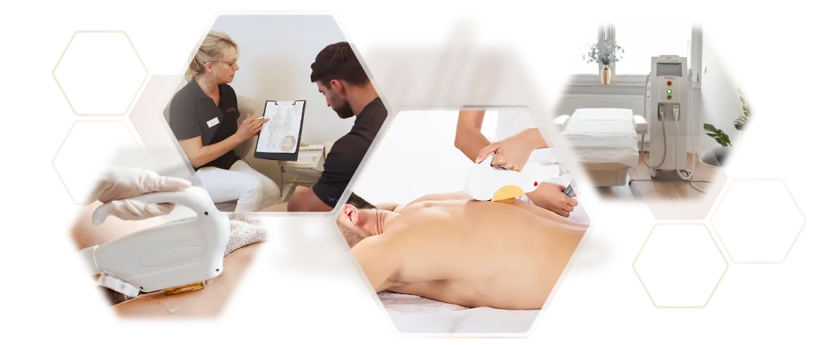 Fotoset Behandlung Expertise beim Mann Rücken Schultern Photoepilation